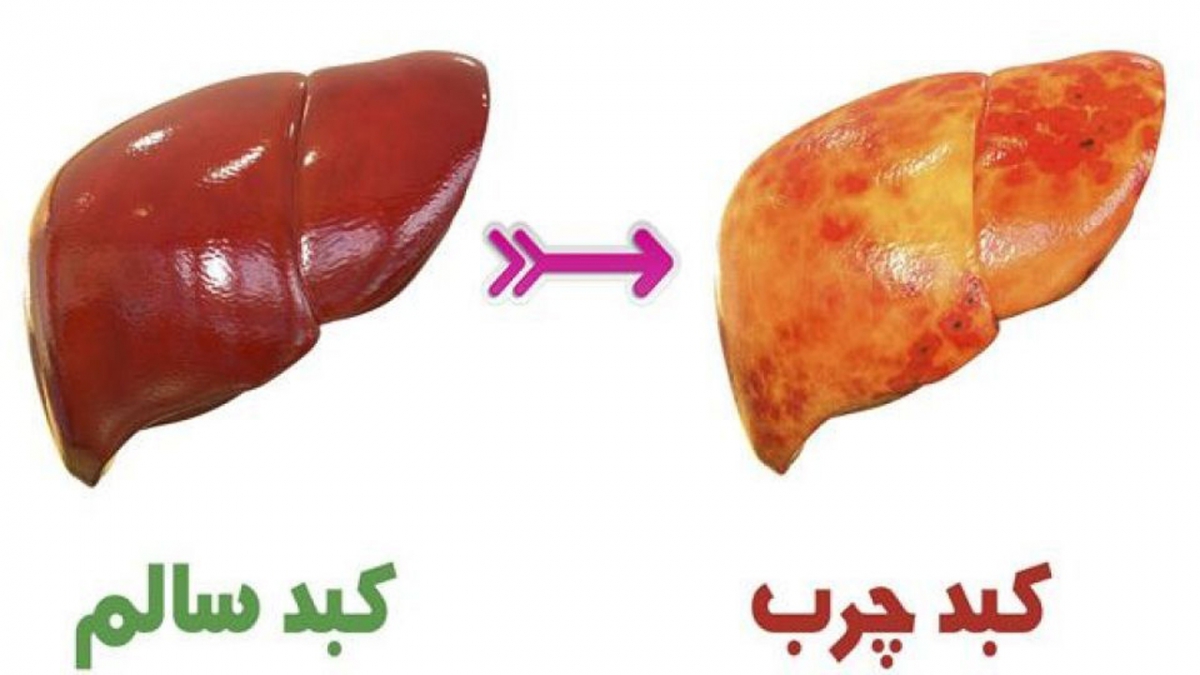 آشنایی با 6 بیماری کشنده و خاموش