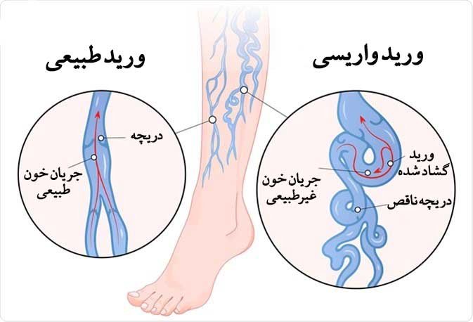 فواید و مضرات دوش آب سرد