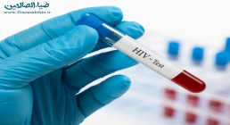 بیماری اچ ای وی - ایدز - HIV